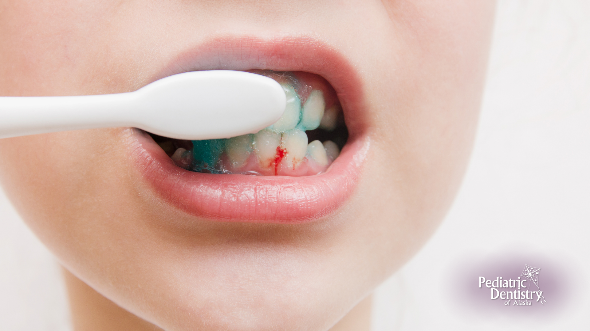 A close up of a person brushing their teeth with a toothbrush.