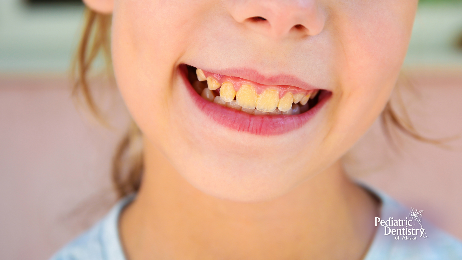 A close up of a young girl 's teeth with a smile on her face.