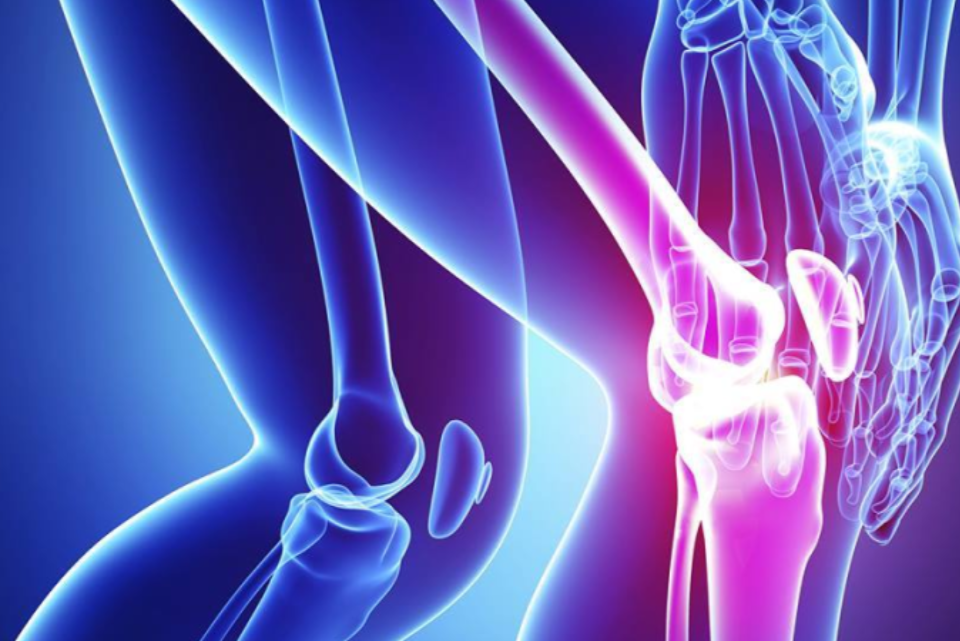 Radiografia di un ginocchio con dolore evidenziato, utilizzando i colori blu e rosso.