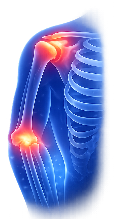 Anatomia del braccio umano con evidenziate le aree doloranti alla spalla e al gomito.
