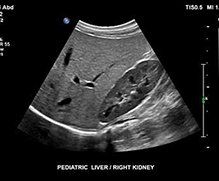abdomen ultrasound