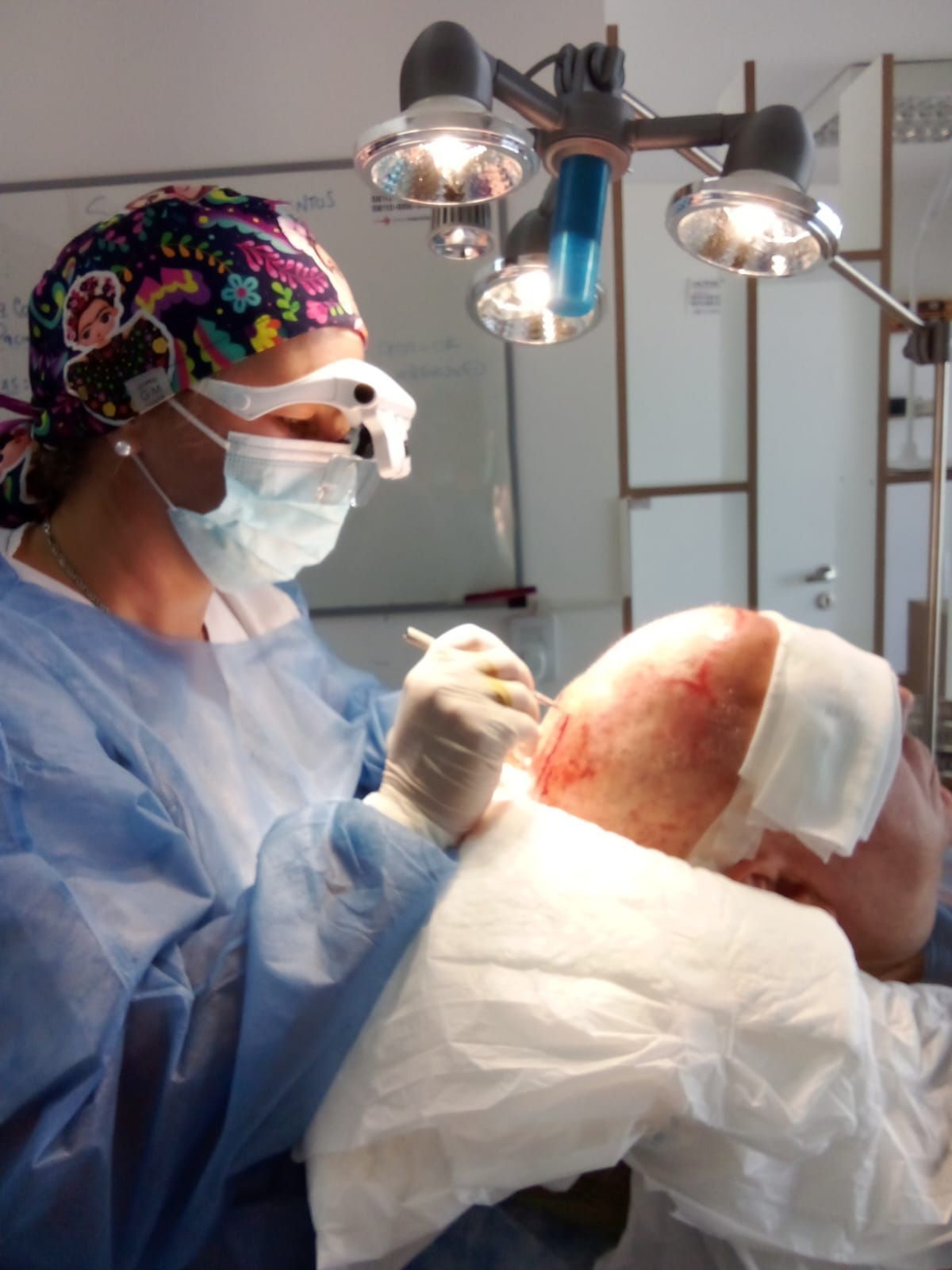 Implante capilar con técnica FUE realizado por profesional especializado en tricología.