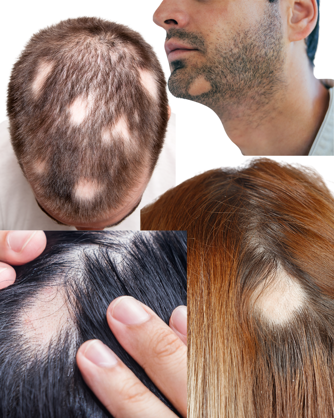 Especialista en salud capilar formando profesionales en implante y tricología.