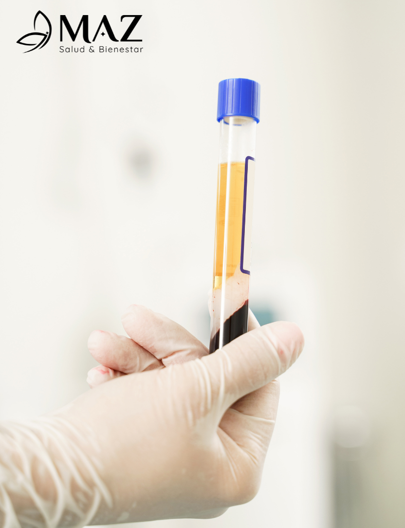 Obtención de plasma rico en plaquetas para tratamiento regenerativo del cuero cabelludo.