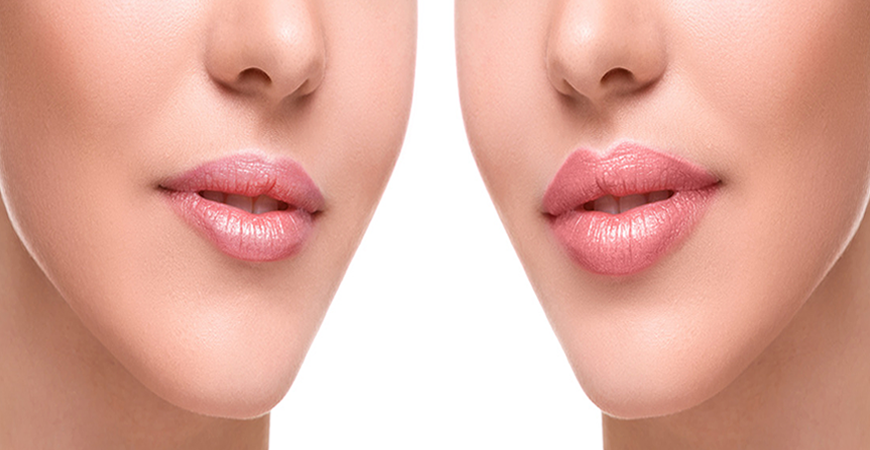 Dauerhafte Haarentfernung Mainz