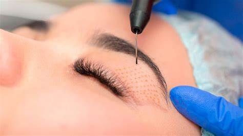 Haarlos Forever Institut in Mainz