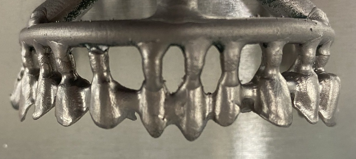 Frameworks are a lightweight, cost-effective option for your teeth