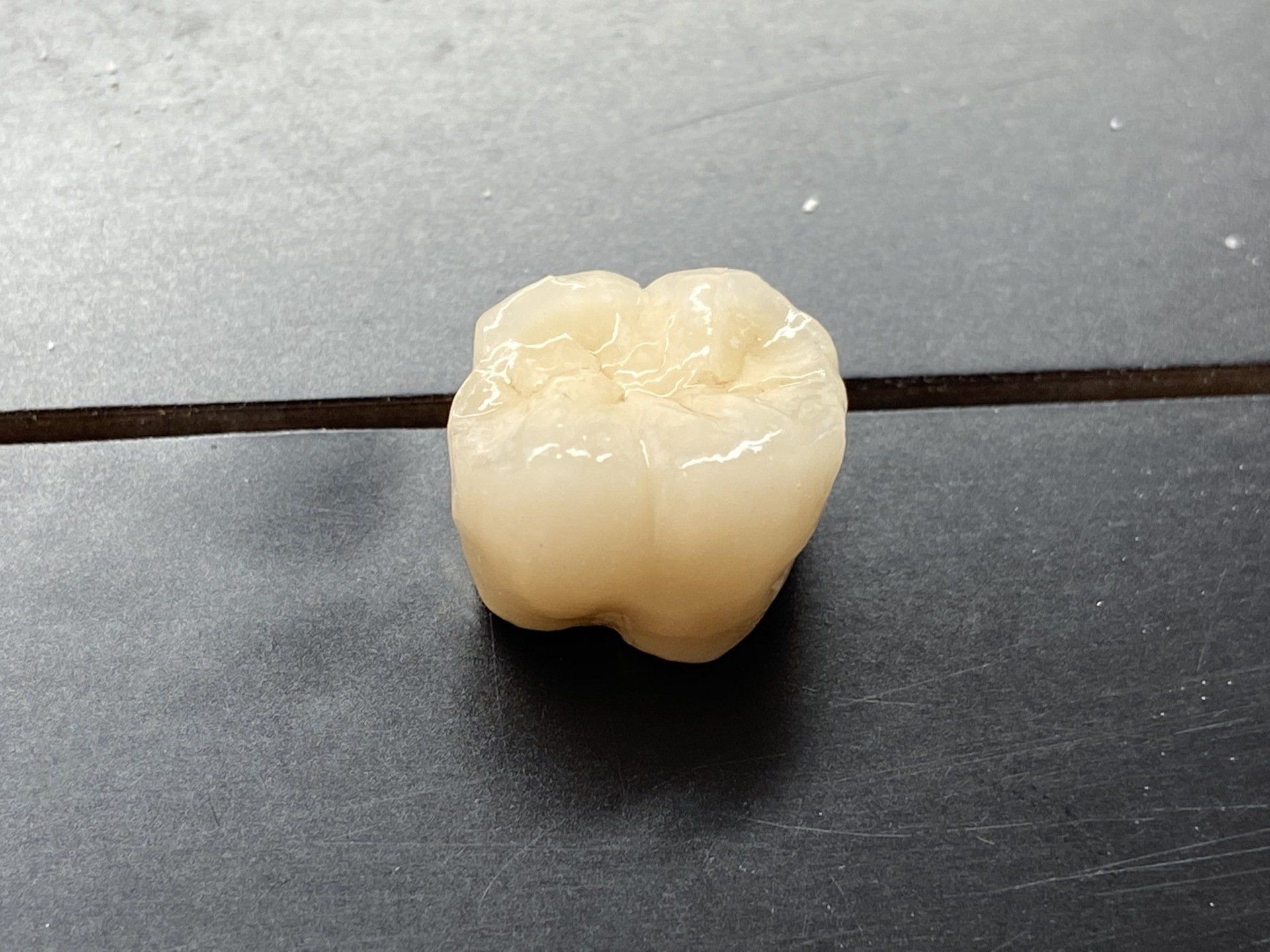 The porcelain-bonded crown bridge unit is a popular, aesthetic and affordable dental bridge
