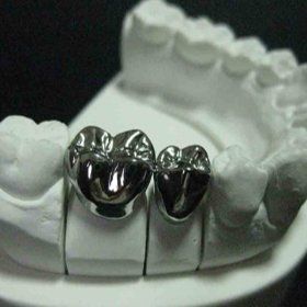 We design and manufacture full-morphology precious and non-precious crowns