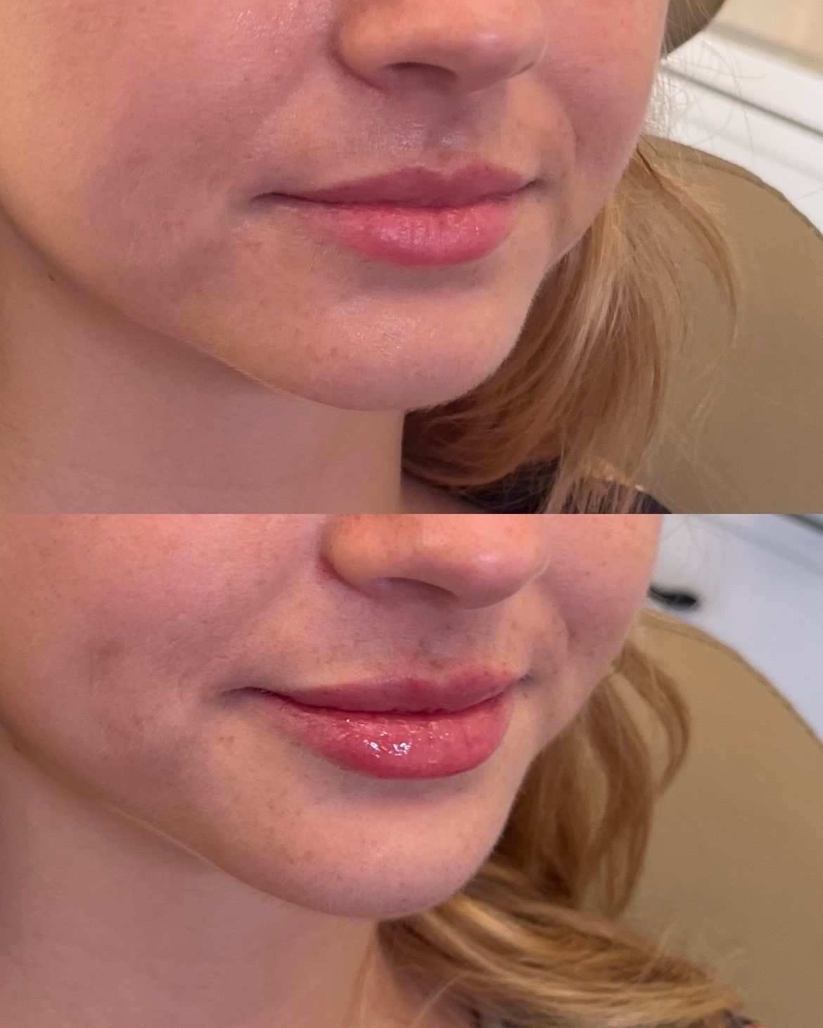 Close-up of a person’s lower face, shown in two stacked views with glossy lips and a slight smile.