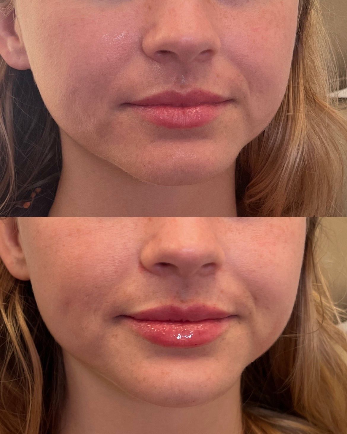 Close-up before-and-after of a person’s lips.