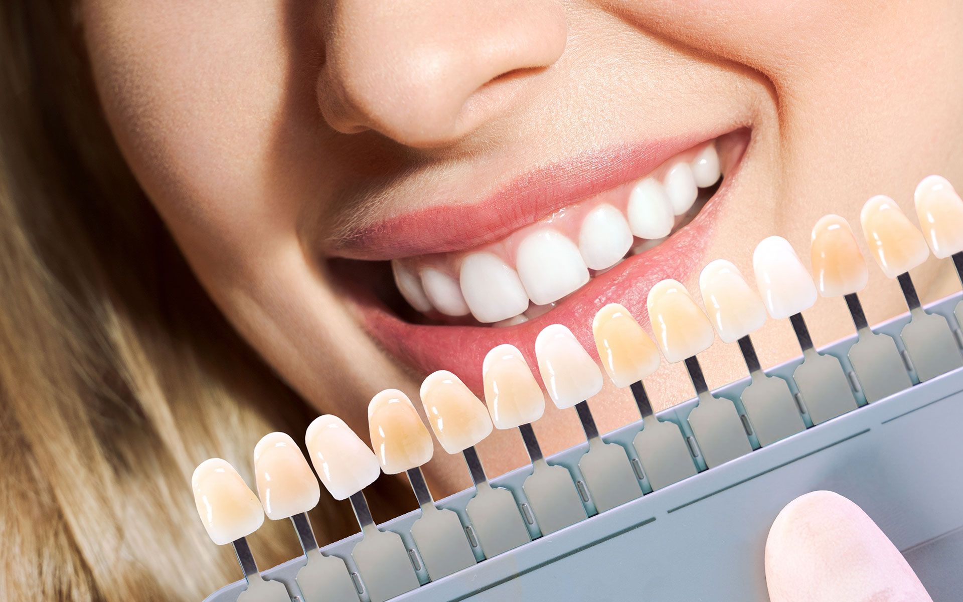 Woman smiling, comparing teeth shade to a professional color chart, showing varying degrees of whiteness.