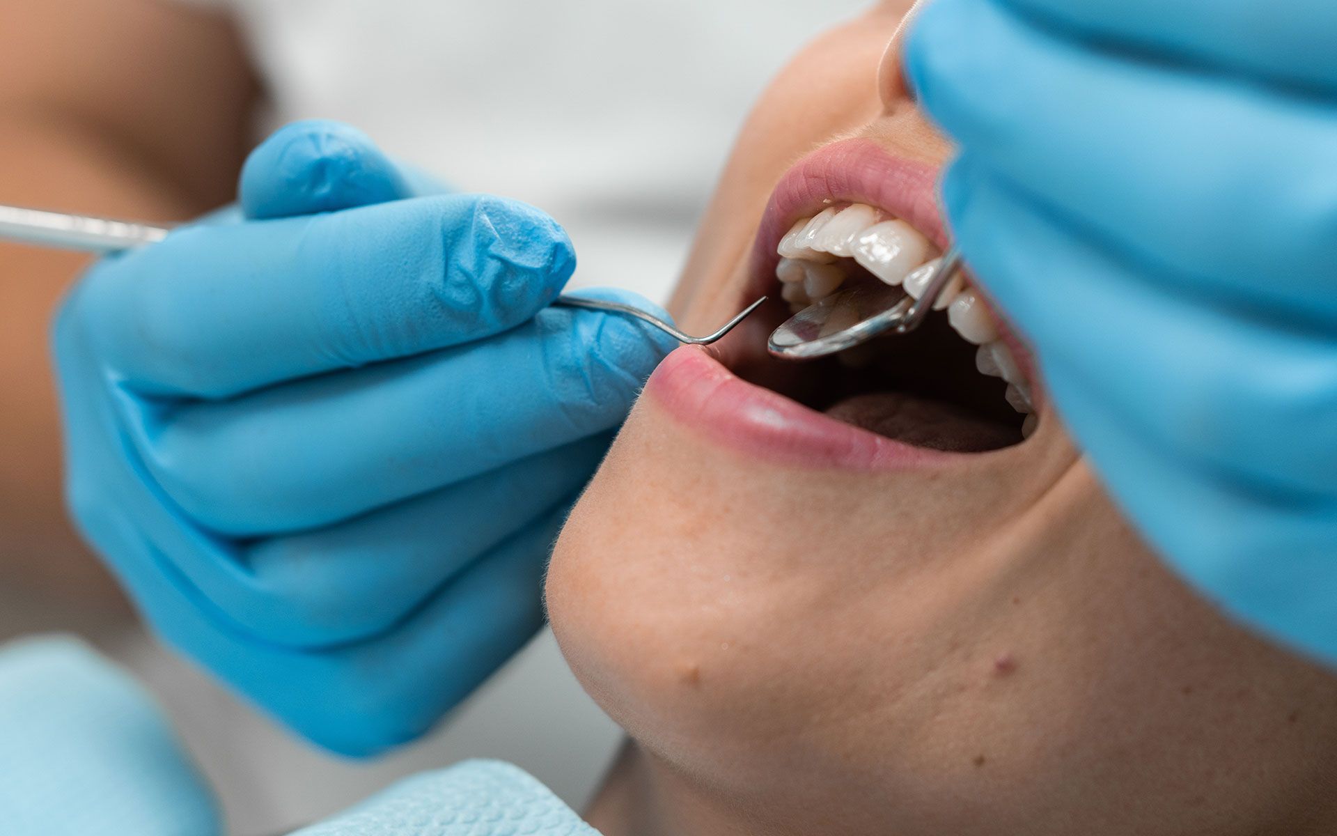 Dentist examining a patient's teeth. The dentist wears blue gloves and holds tools. Patient's mouth open.