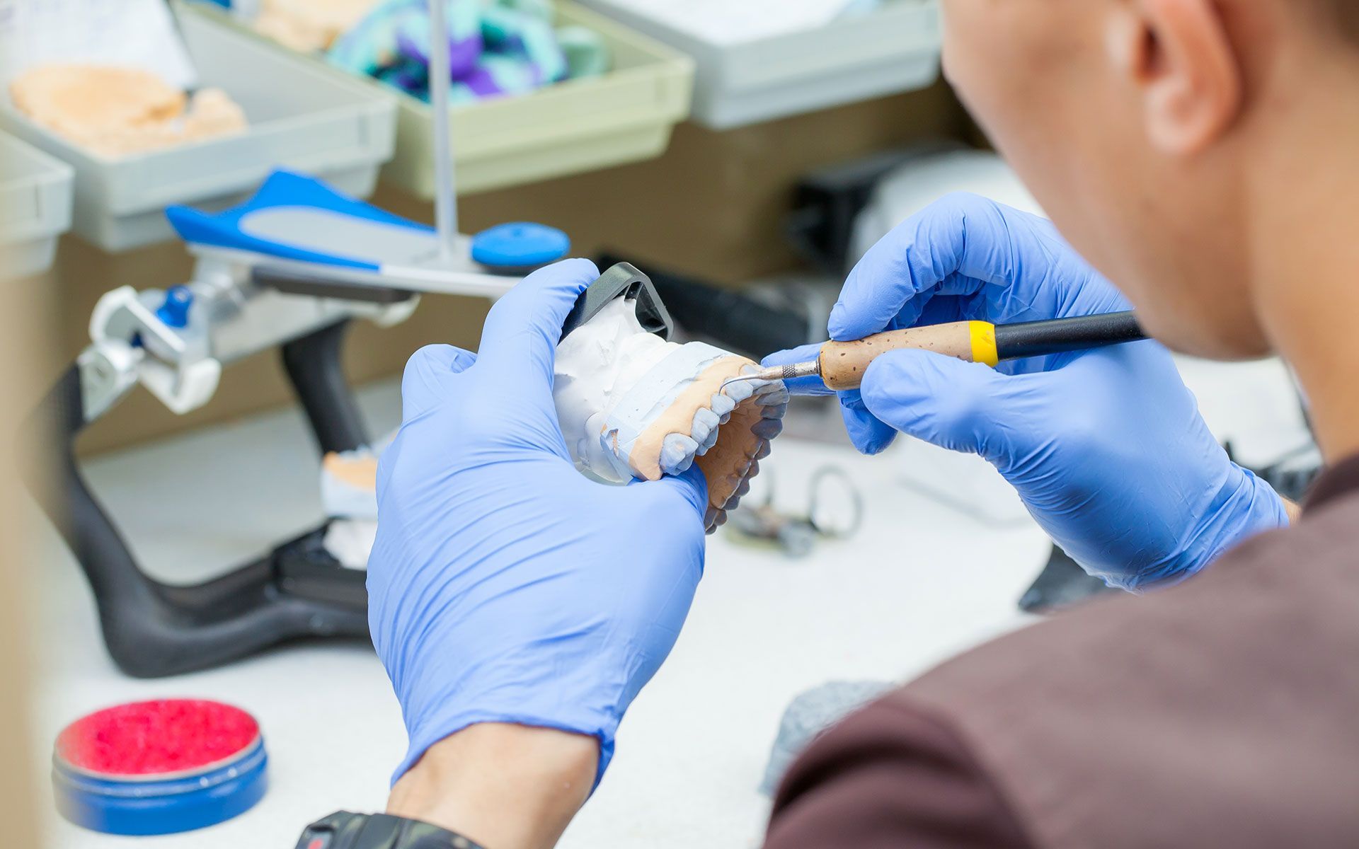 Person in blue gloves working on dental model with a tool.
