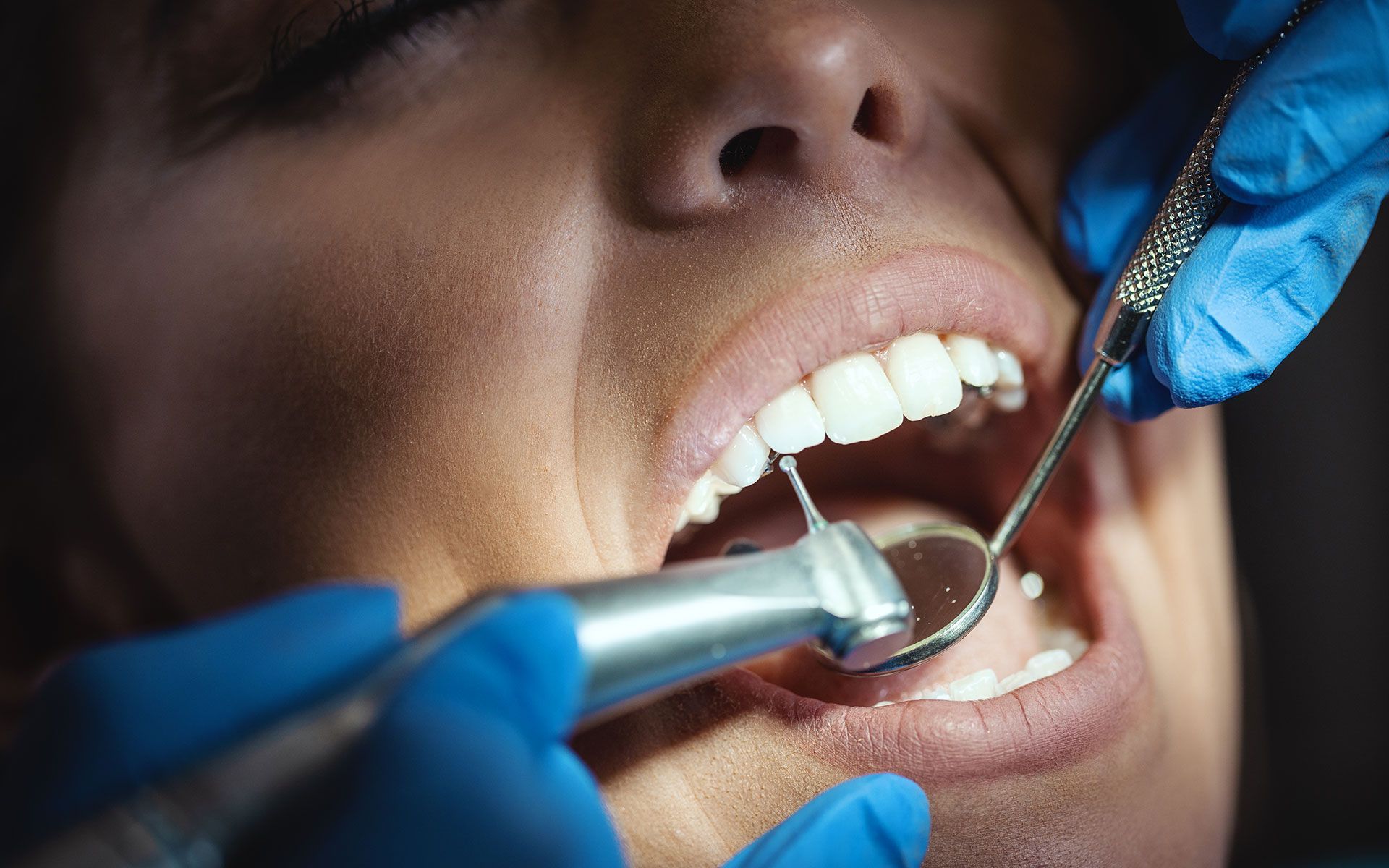 Dentist examining patient's teeth with dental tools, close-up.