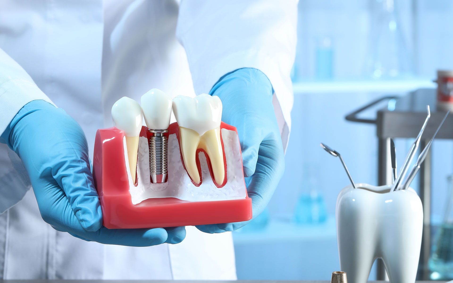 Dentist holding a model of a tooth implant, showing its components.