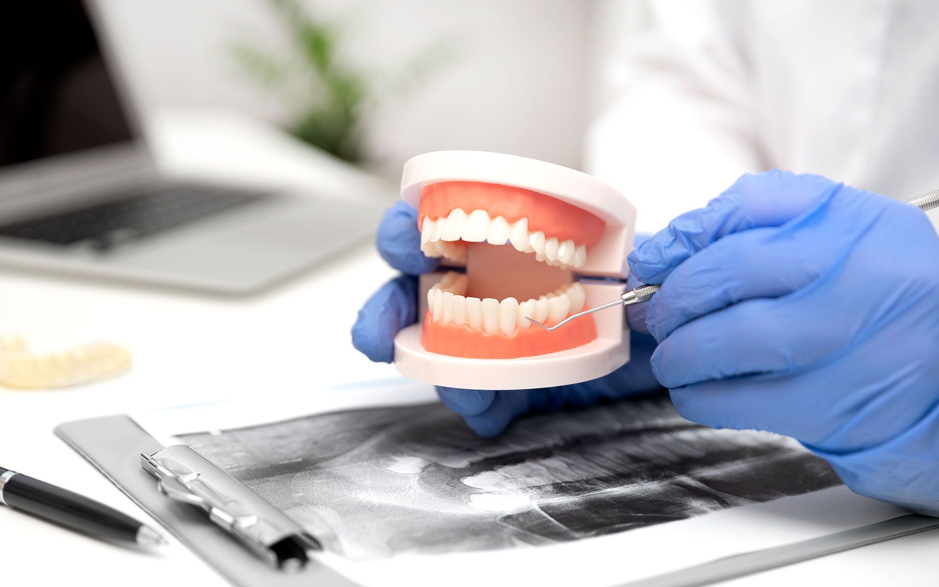 Dentist holding a model of teeth, examining it with a dental tool