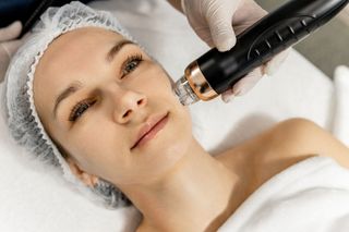 Woman receiving micro-needling facial treatment. Practitioner uses device on her cheek; she wears a hair cap.