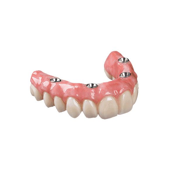 Fiksuojami (neišimami) dantų protezai 