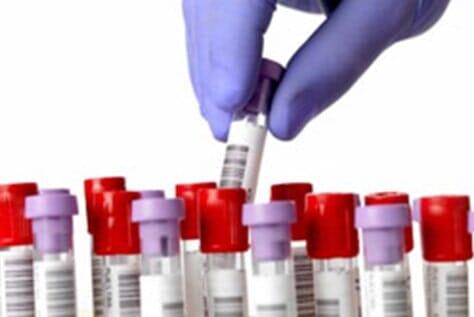 LABORATORIOS DE ANÁLISIS CLÍNICOS ESPECIALIZADOS DE SALTILLO SA DE CV