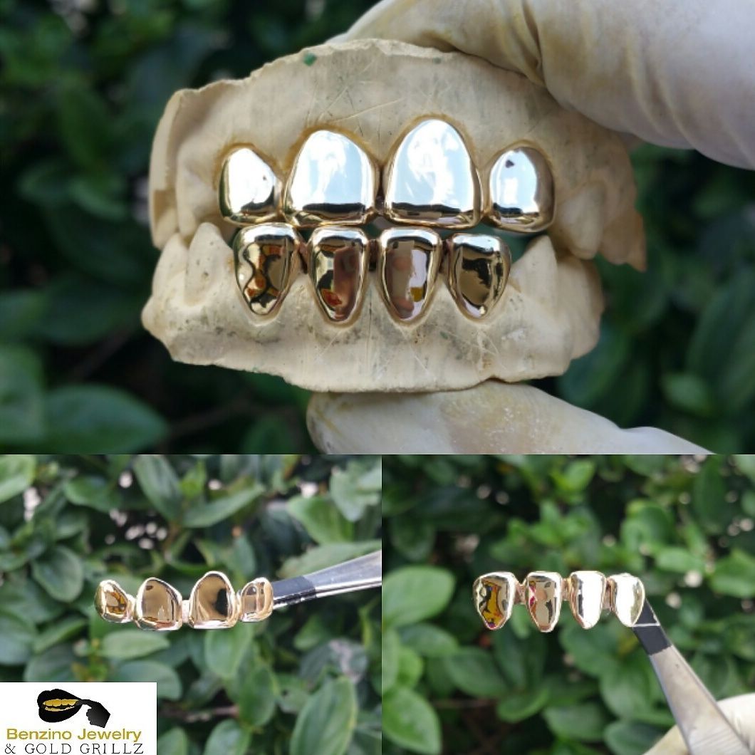 gold teeth fronts