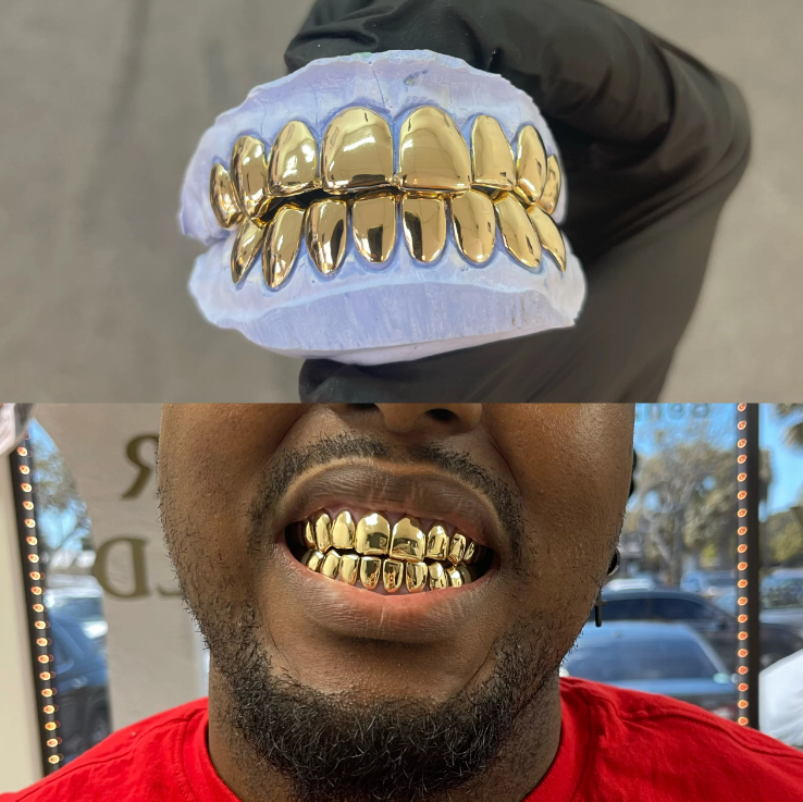 gold front teeth