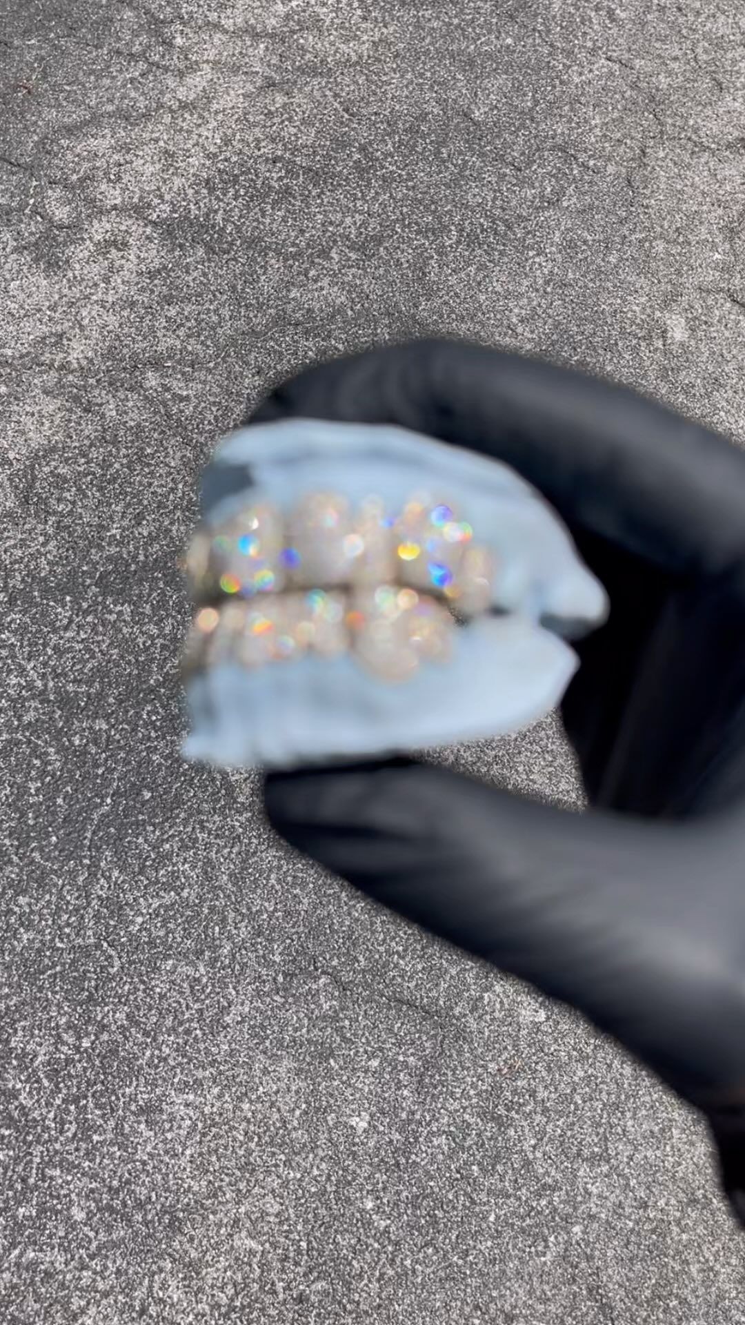 custom grill for teeth