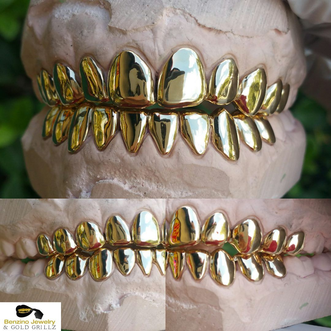 gold crown teeth