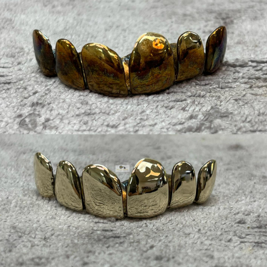 Comparison of plated grillz versus real custom gold grillz teeth