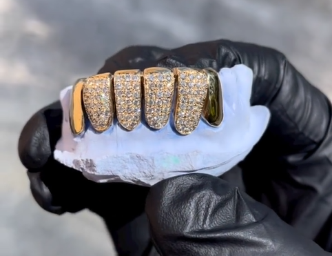 diamond grillz florida