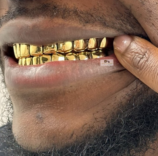 Closeup smile wearing full gold grillz top and bottom teeth set