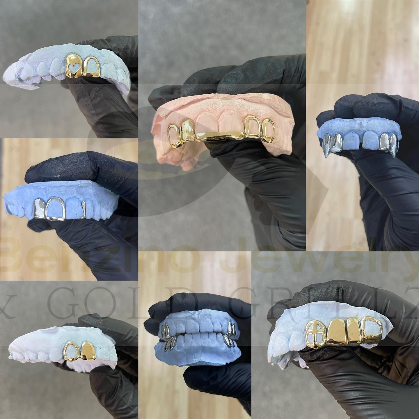 Collage of custom cuff grillz in gold and silver designs, grills teeth Florida