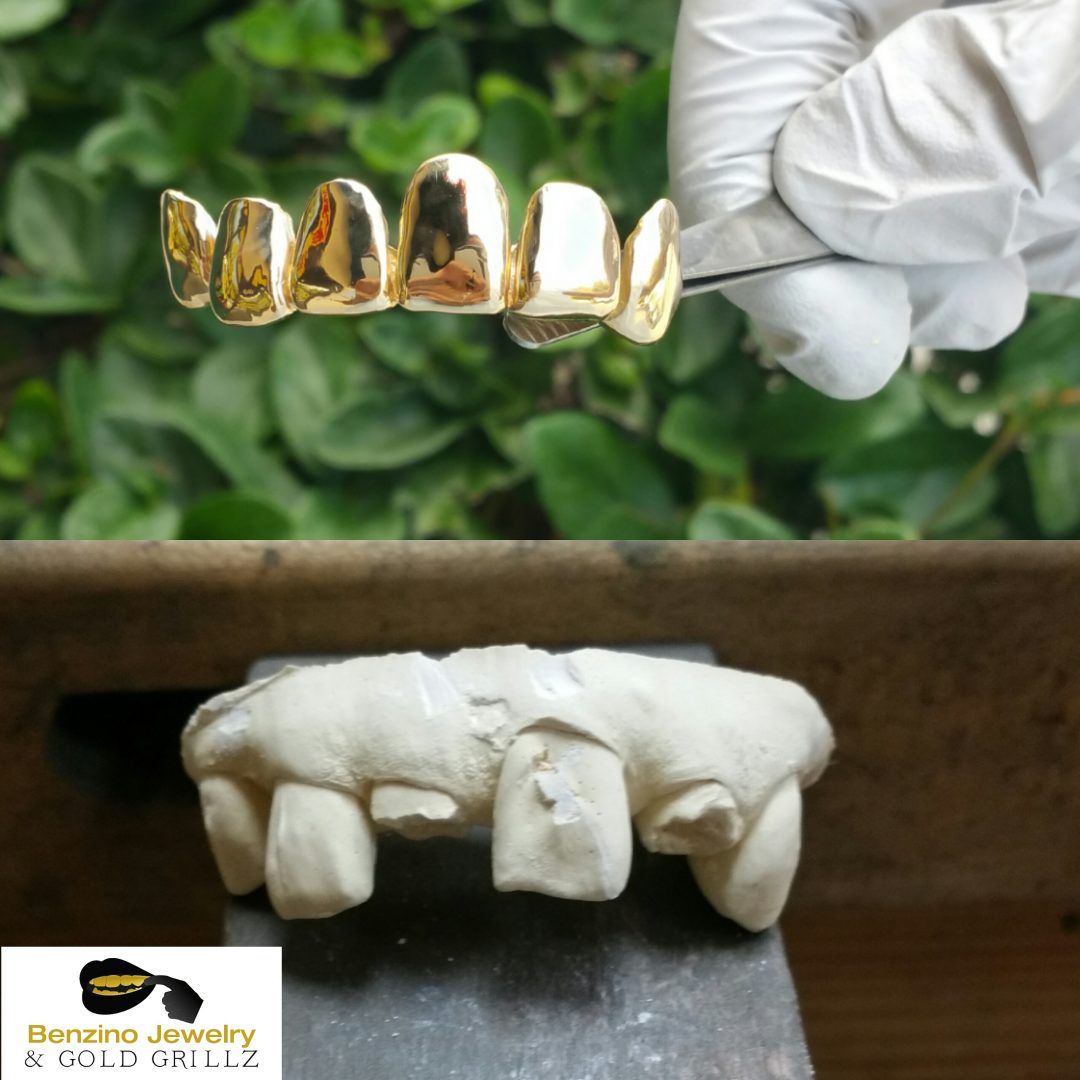 gold crown teeth