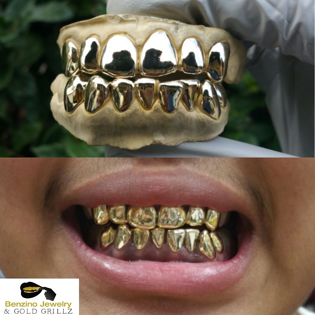 custom grill for teeth