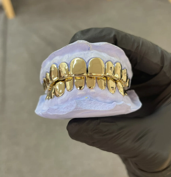 gold crown teeth