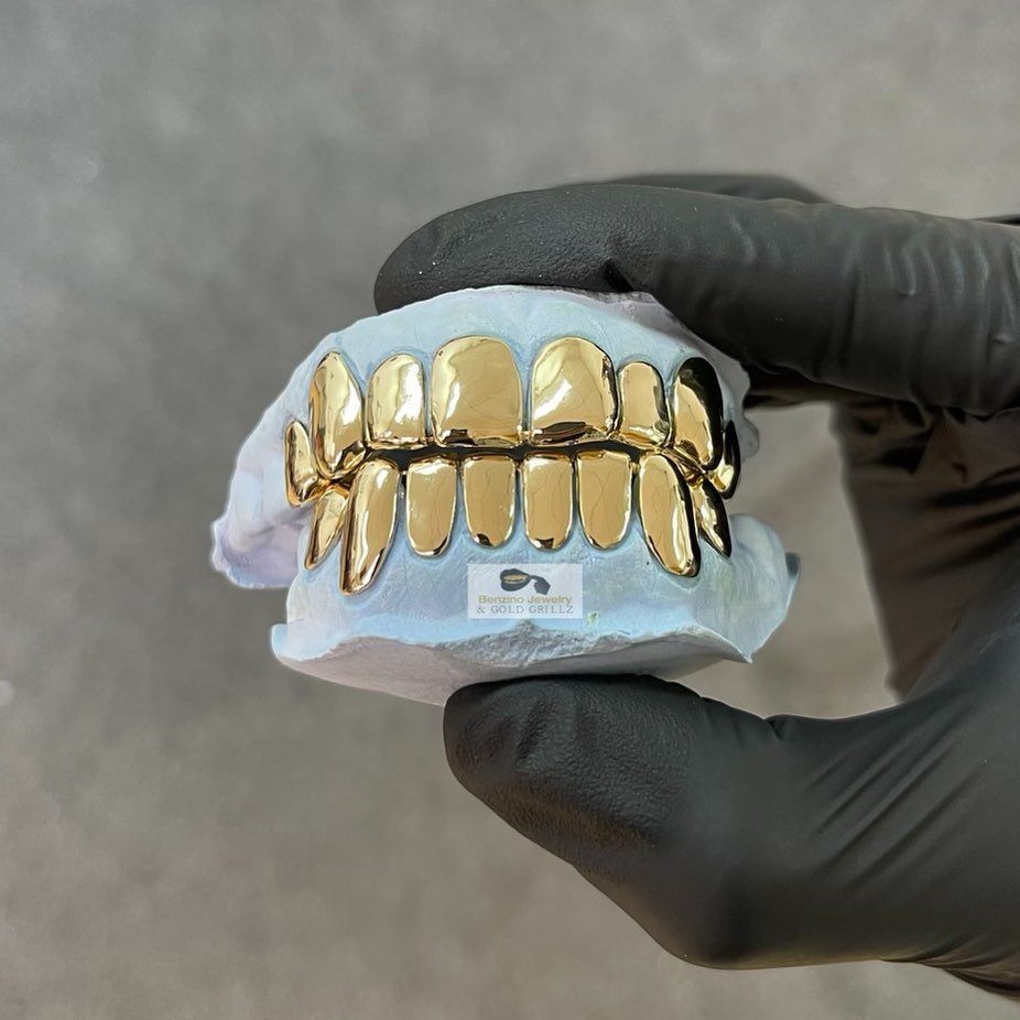 Luxury full gold teeth fronts, dental gold grillz for top and bottom