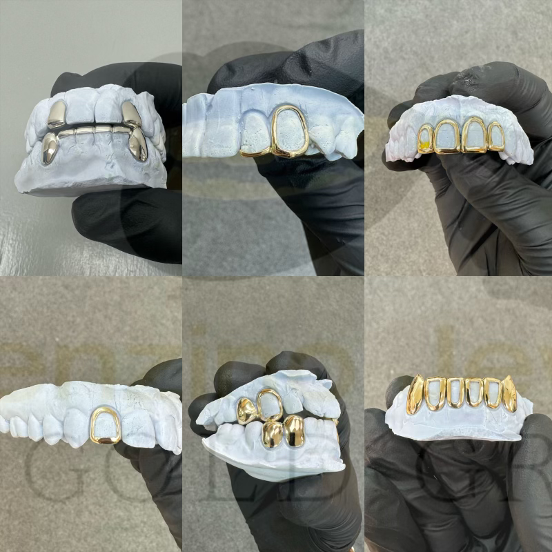 Gold and silver grillz cuff collection, custom grill for teeth South Florida