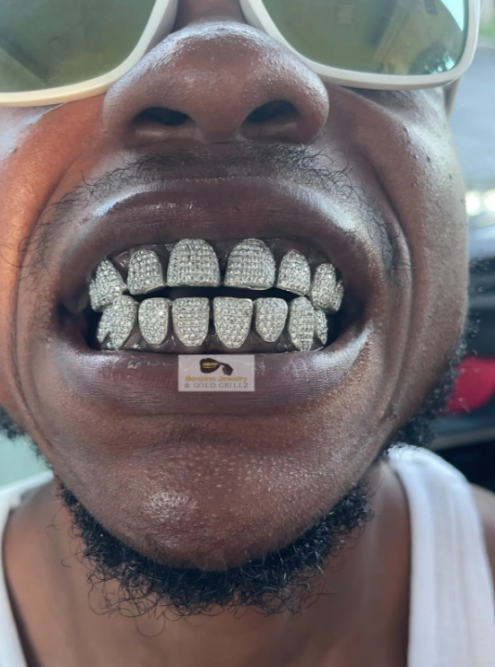 grill for teeth