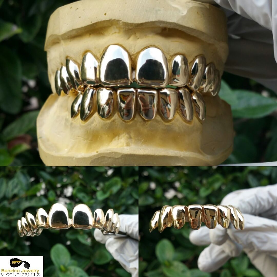 gold grillz florida