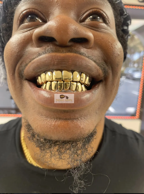gold tooth
