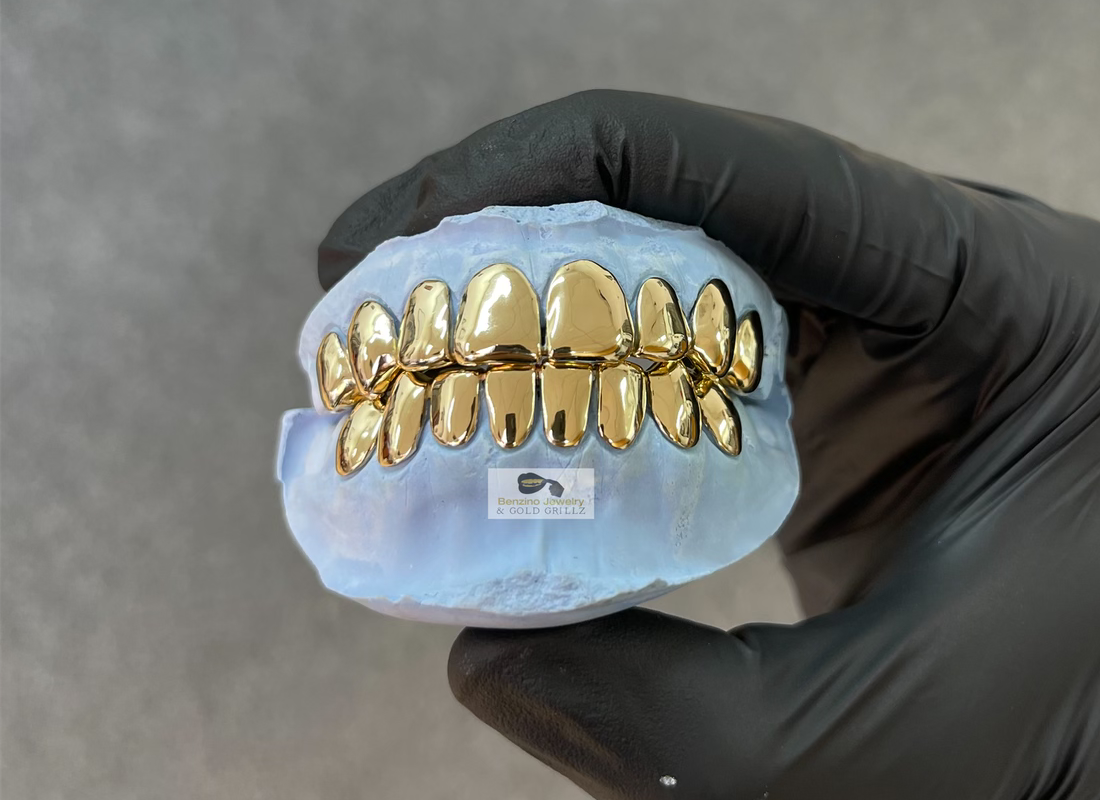 Complete gold grillz set for top and bottom teeth, custom grillz Florida