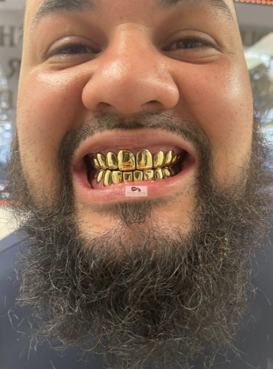 gold crown teeth