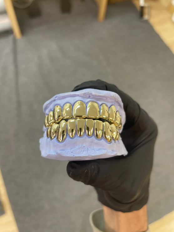 gold teeth fronts