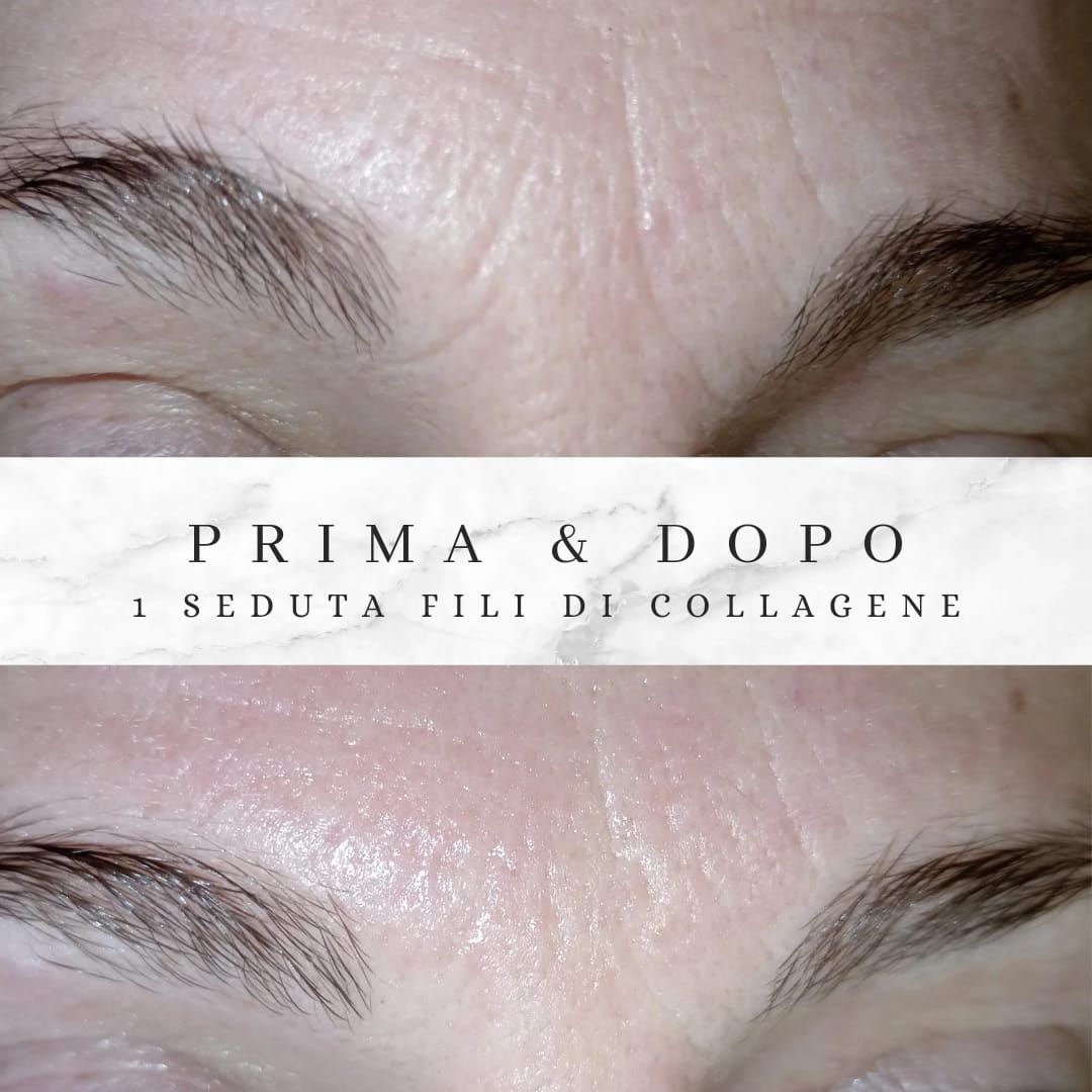  fili di collagene sopracciglia
