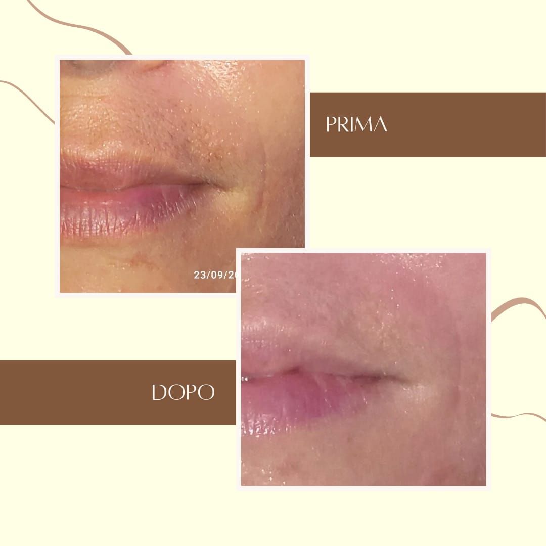 luce di venere mento