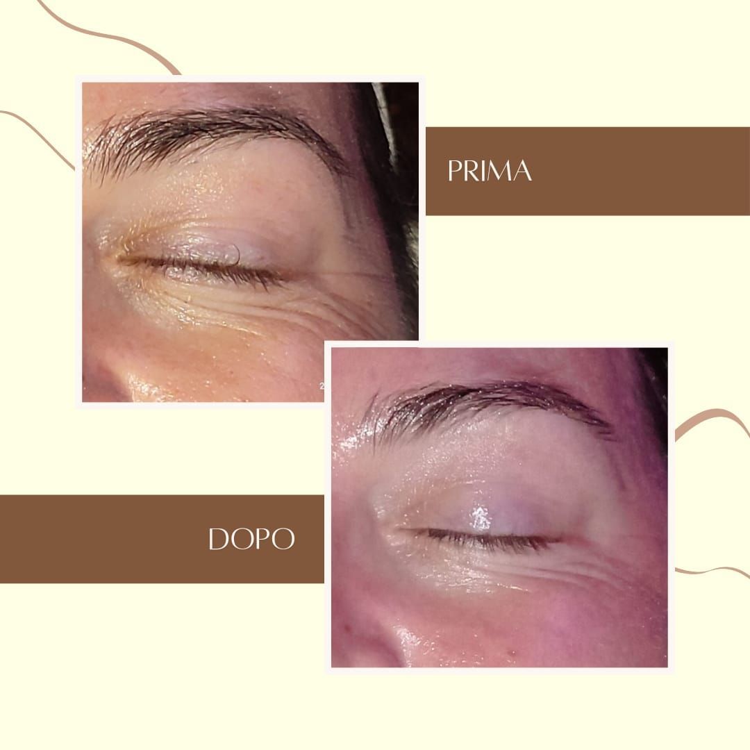 luce di venere occhiaie