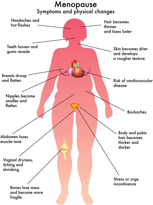 Diagram of a woman showing physical changes and symptoms of menopause.