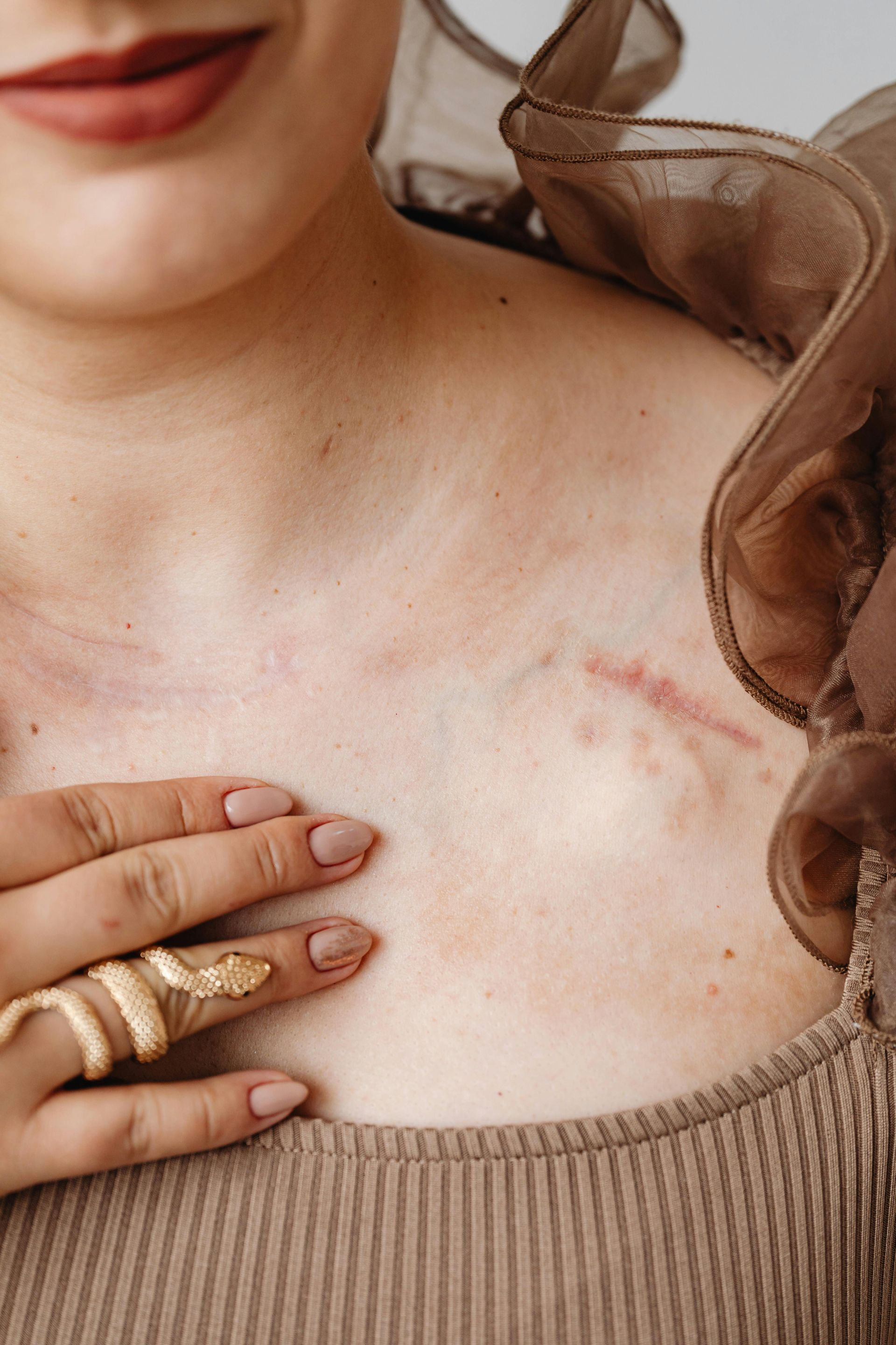 A woman with a scar on her chest is holding her chest with her hands.