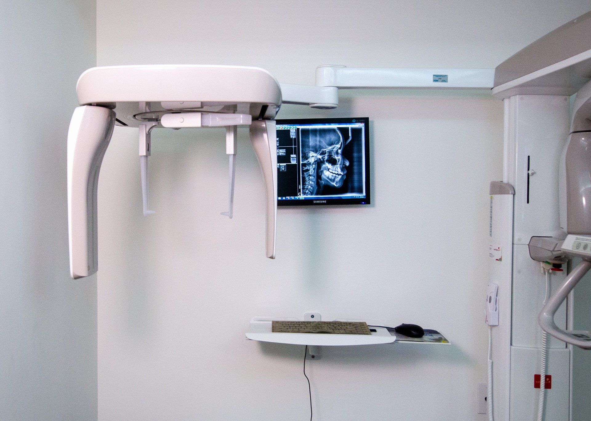 Apparecchio per radiografie dentali con monitor che visualizza un'immagine su una parete bianca in uno studio dentistico.