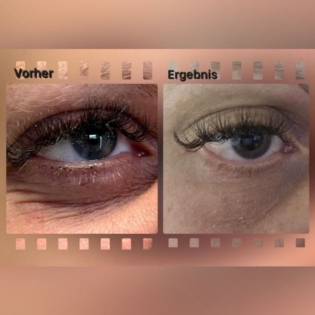 Ein Vorher-Nachher-Bild des Auges einer Frau